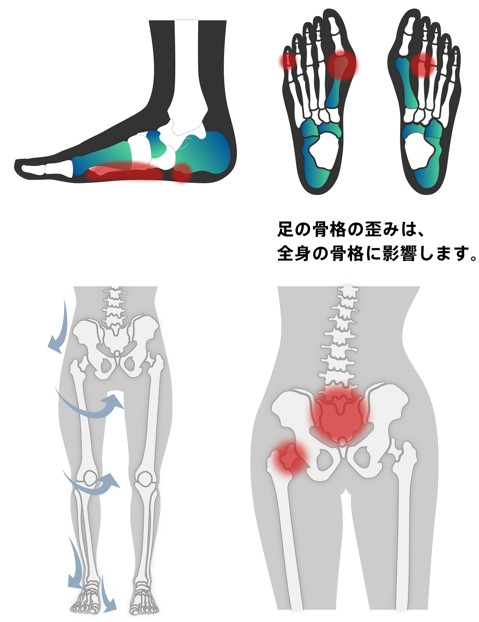 足の骨格の歪みは、全身の骨格に影響します。