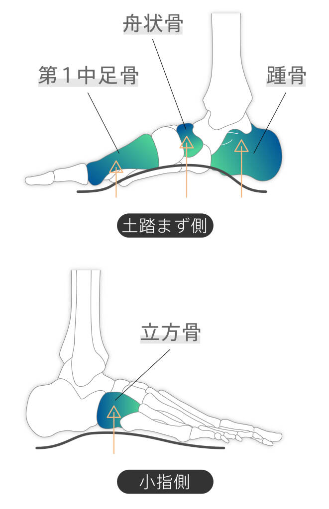 骨格補正プレート - 歪みやすい踵骨（載距突起）、立方骨、舟状骨、第1中足骨の4点を補正し、歩きやすく、疲れにくい